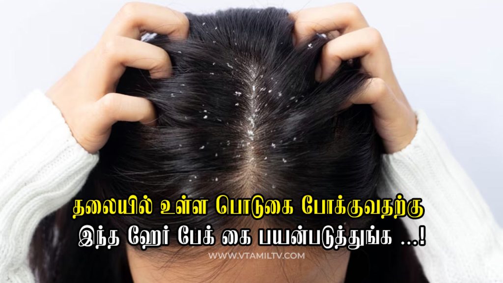 Dandruff Home Remedies